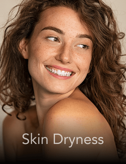 A lady with dry skin smiling.