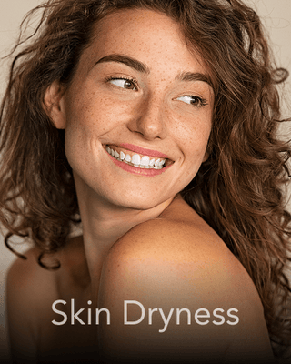 A lady with dry skin smiling.